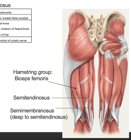 <p>Origin</p><ul><li><p>ischial tuberosisty</p></li></ul><p>Insertion </p><ul><li><p>postterir medial tibial condile </p></li></ul><p>action </p><ul><li><p>flexion of knee</p></li><li><p>internal rotation of flexed knee</p></li><li><p>extension of the hip </p></li></ul><p>Nerve supply</p><ul><li><p>tibial division of sciatic nerve</p></li></ul><p></p>