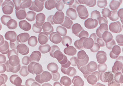 <p>Red and white blood cells in a</p><p class="p1">fluid matrix (plasma).</p><p class="p1">-Transport of respiratory gases, nutrients, wastes and other substances.</p>