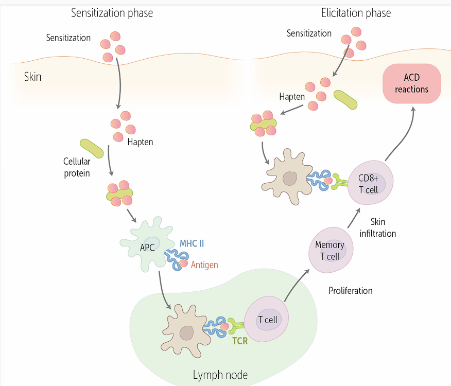 <p>Sensitization — body takes in the allergen and it will be presented on APC’s membrane through MHC</p><p>The midpoint is <strong>lymph node, where APC presents antigen to T cell</strong></p><p>T cell will bind with TCR and cause <strong>proliferation of memory T cells which infiltrate the skin, and become CD8 T cells that when interacting with the antigen again, will cause ACD reactions</strong></p><p>In the <strong>elicitation phase, </strong>the hapten/allergen will be presented to the memory T cell, <strong>causing an immune response</strong></p>