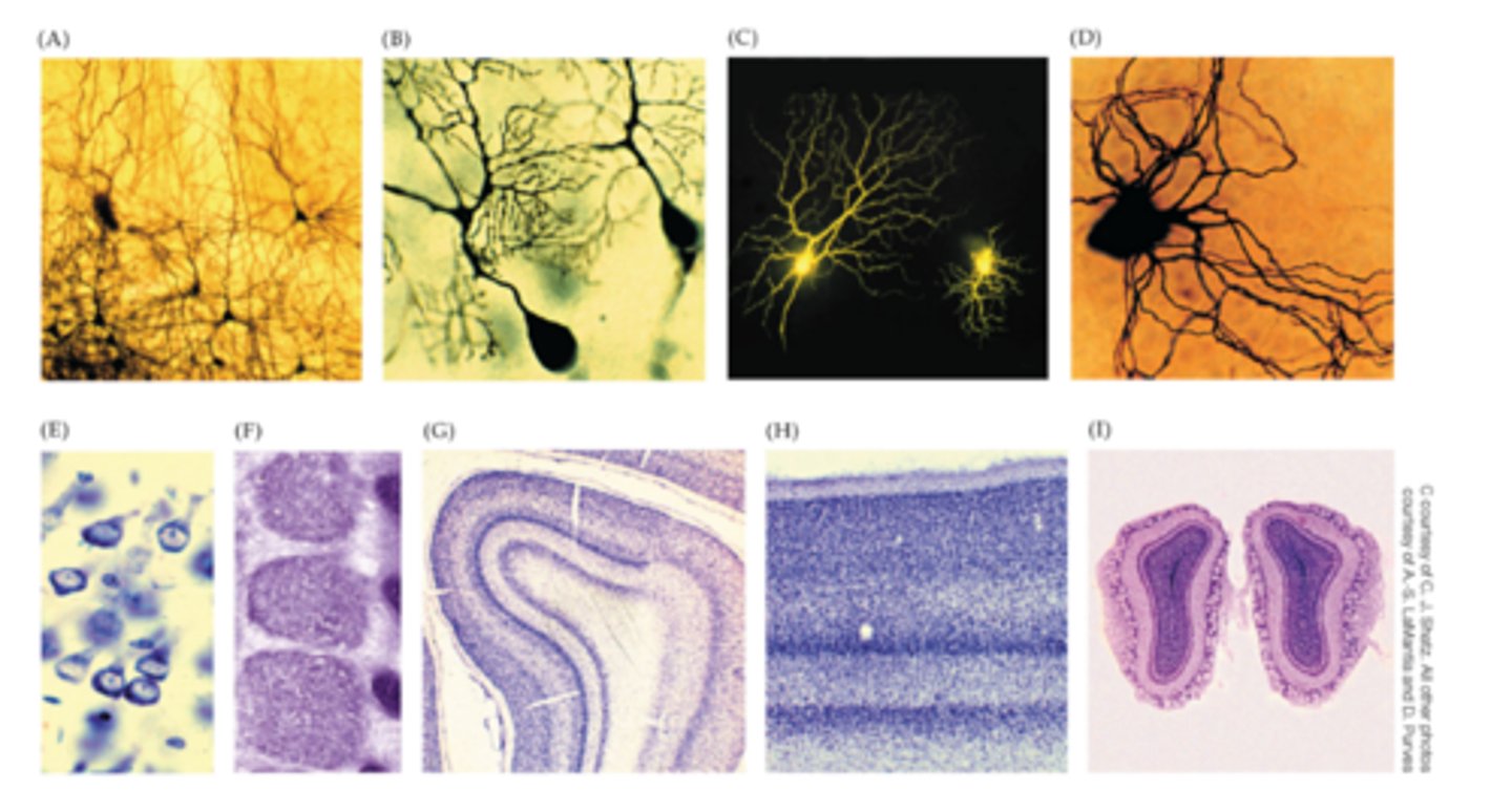 <p>Intracellular injection of fluorescent dye labels two retinal neurons that vary dramatically in the size and extent of their dendritic arborizations</p>