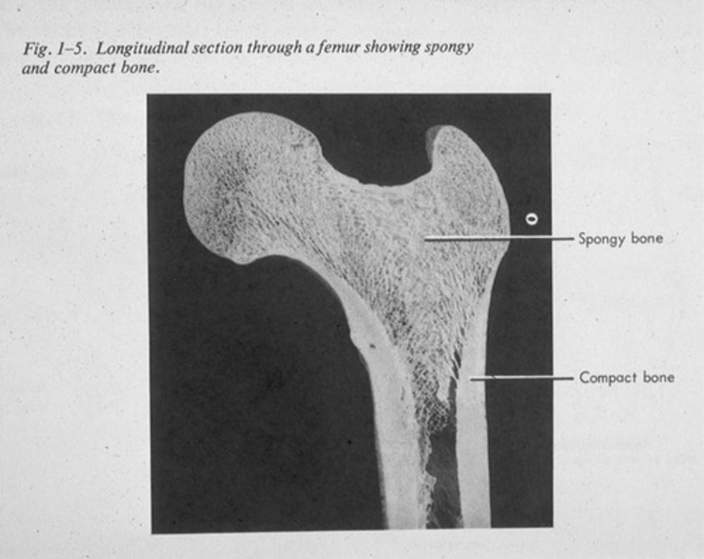 <p>includes dense/compact part (outer part of bone) and spongy/cancellous part (interior part of bone).</p>
