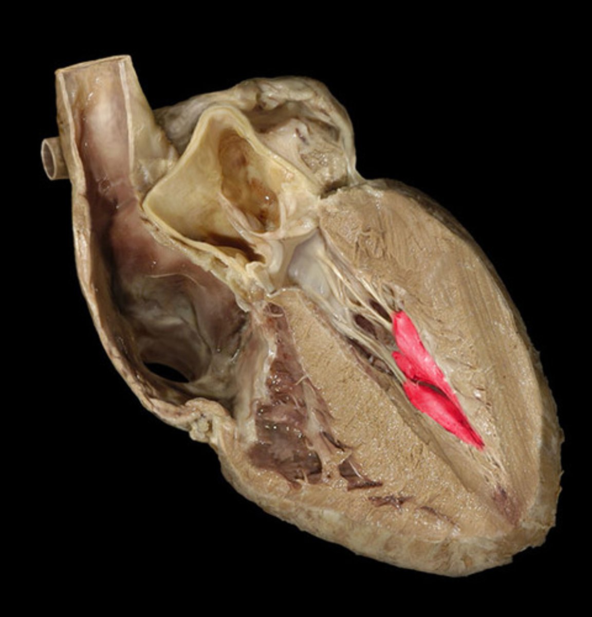 <p>What muscle is this?</p>
