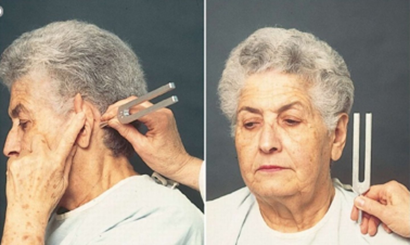 <p>In the ____ test, a vibrating tuning fork is placed at on the patient's mastoid process to test bone conduction. It is then moved to be parallel with the ear to test air conduction.</p>