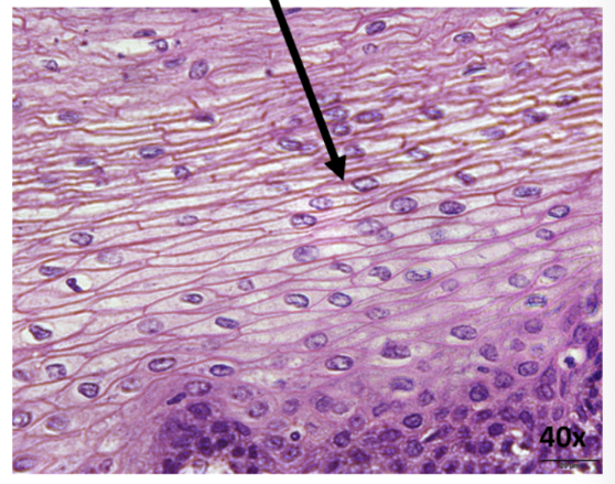 <p>What is this epithelial tissue?</p>