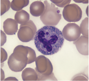 <p>Basophil</p>