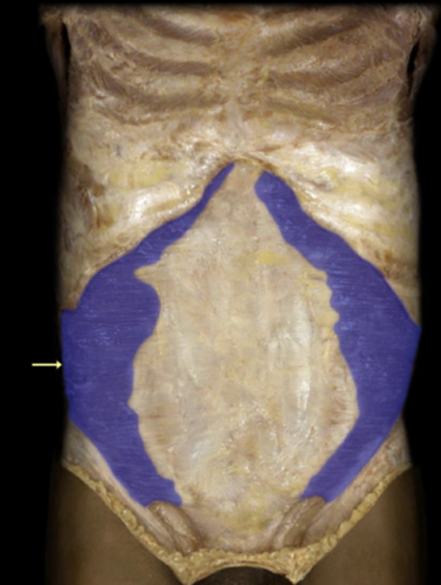 <p>action of transverse abdominus</p>