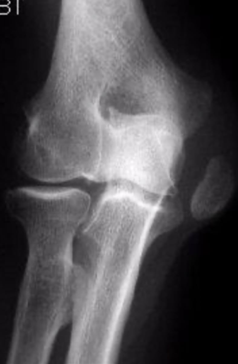 <p>What is the issue?</p>