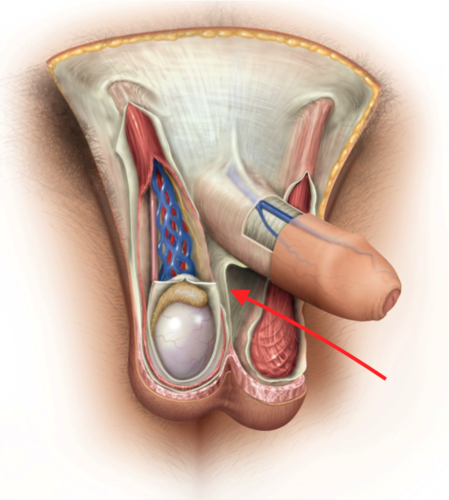 <p>divides scrotum into R/L compartments</p>