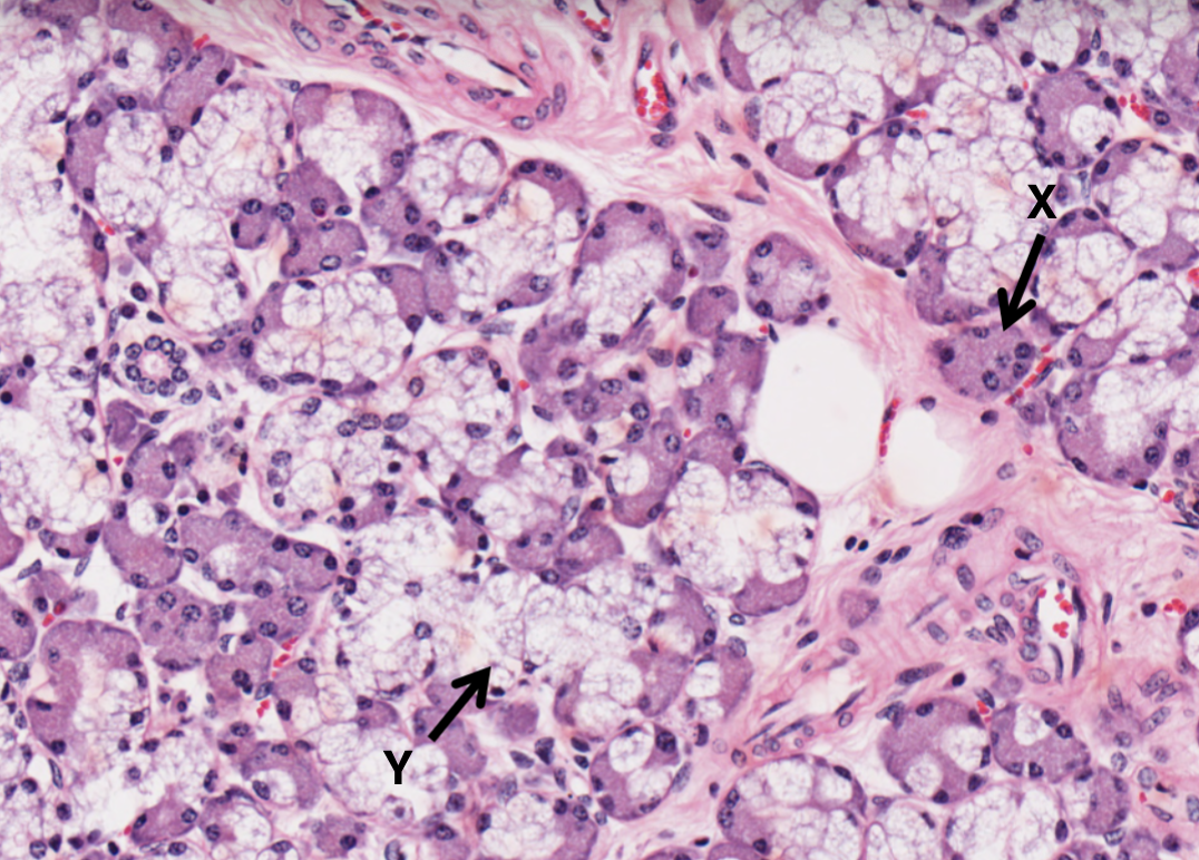 <p>What type of cell is Y in the salivary gland?</p>
