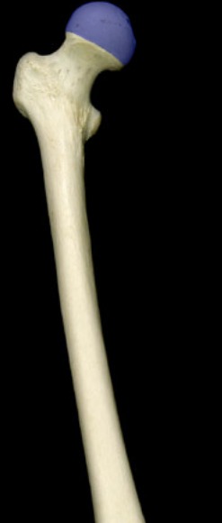 <p>round, ball head; sits in acetabulum; medial</p>