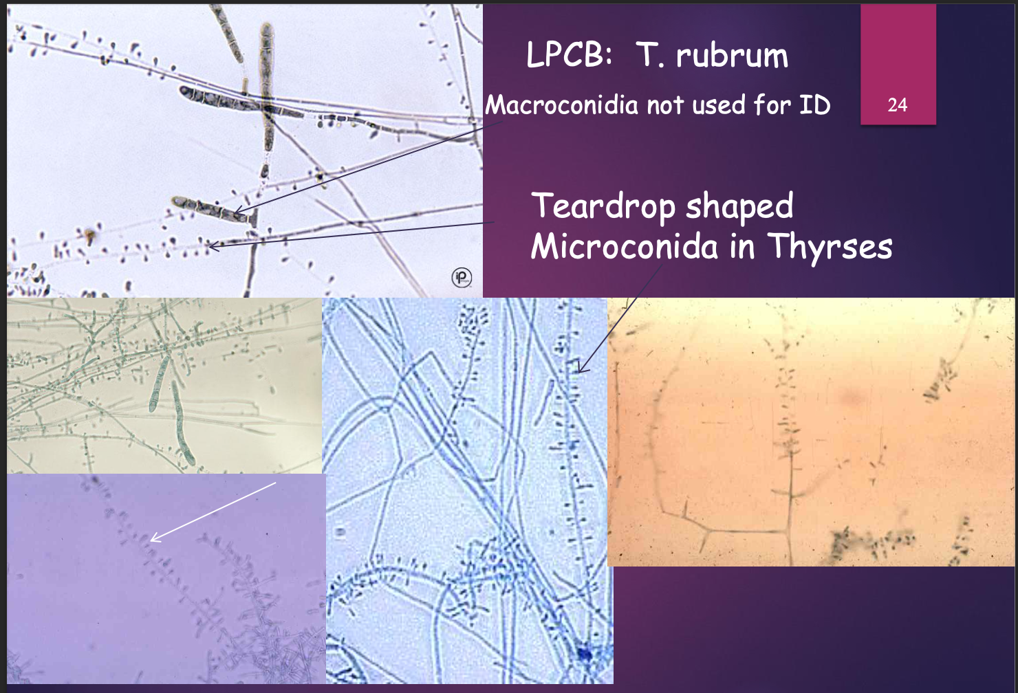 <p>Dermatophytes microscopic &amp; colony ID: Trichophyton rubrum. Label the structures found in dermatophyte microscopic image</p>
