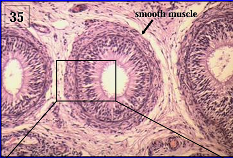 <p>Ductus epididymidis, equine. </p><p>Notice the circularly arranged smooth muscle fibers surrounding the duct; this layer is thicker than the smooth muscle layer surrounding the duct in the head of the epididymis. </p><p>Smooth muscle contraction helps move the spermatozoa along the duct system.</p>