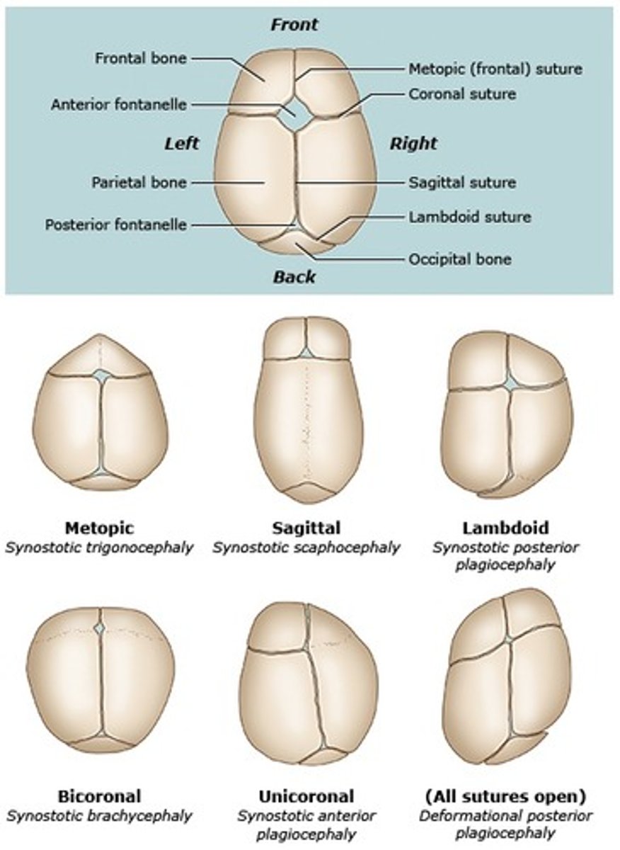 <p>- sagittaal meest voorkomend</p>