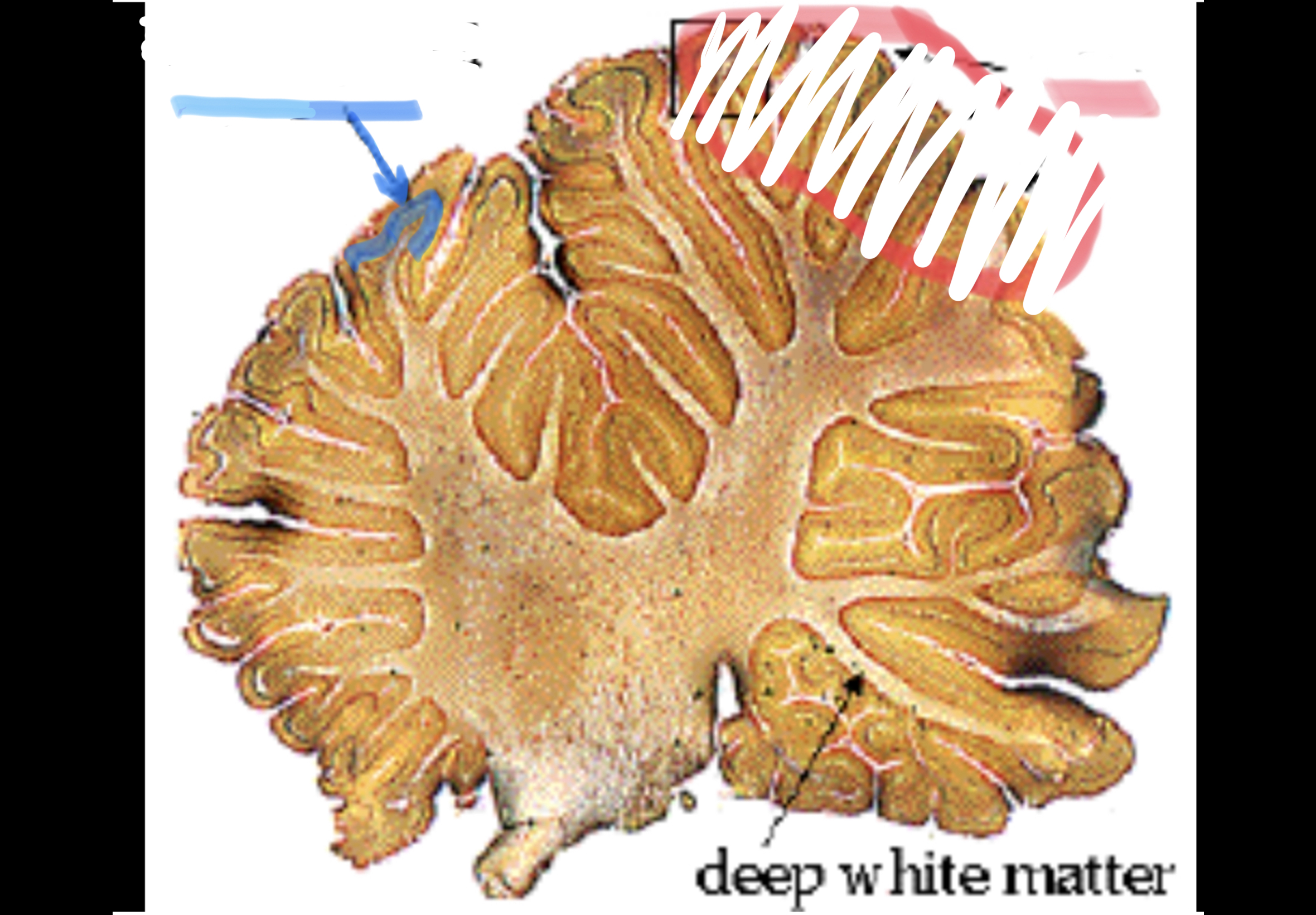 <p>a large densely branching neuron that is the characteristic cell of the cerebellar cortex</p>