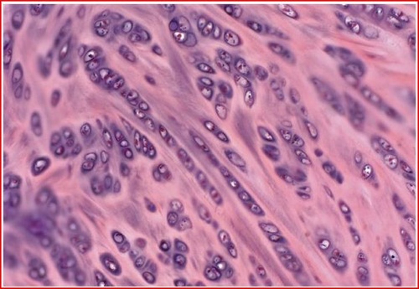 <p>Tough cartilage with parallel collagen fibers, located in intervertebral discs for shock absorption.</p>