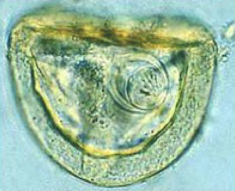 <p>Fecal flotation</p>