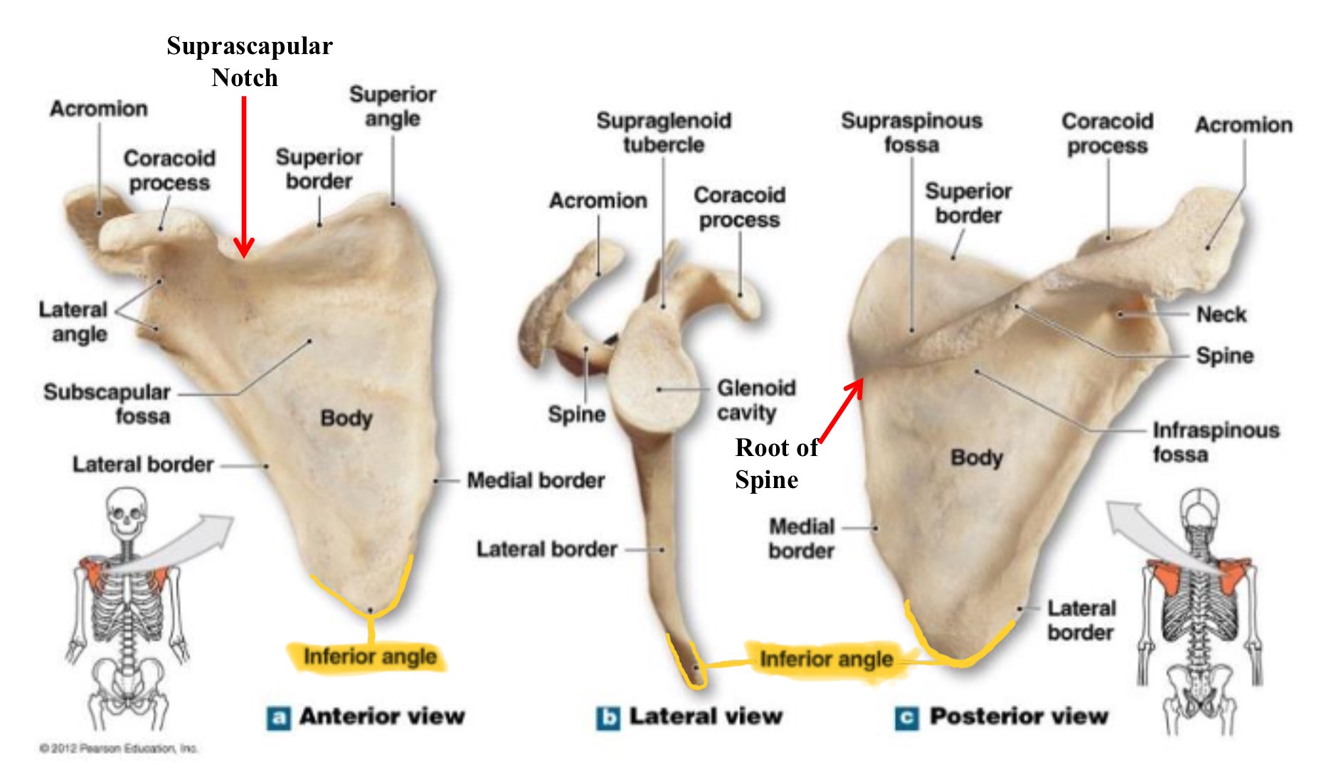 <p>inferior angle of scapula</p>