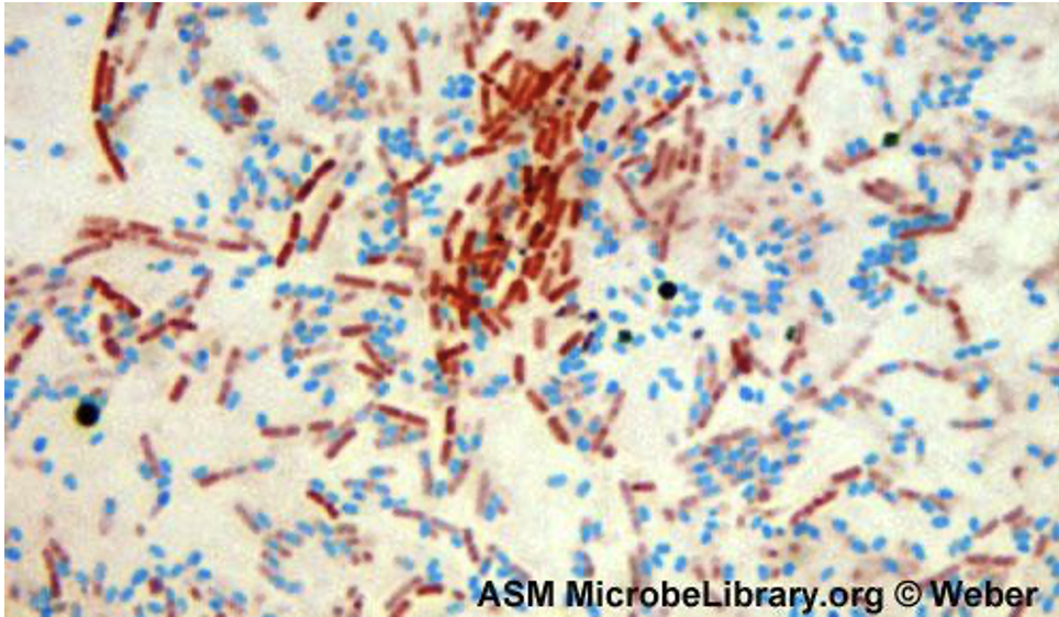 Bacillus cereus (endospore stain) 