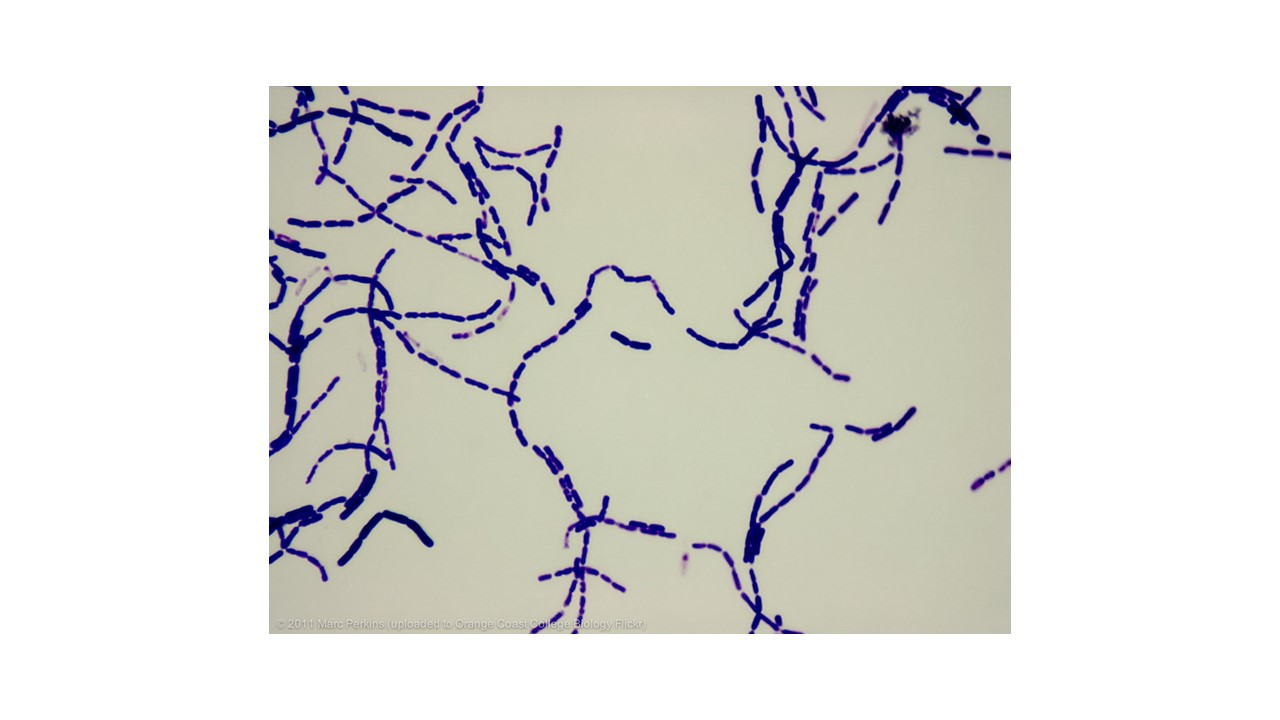 <p><span>looking at the micrograph, is Bacillus megaterium Gram positive or Gram negative</span></p>
