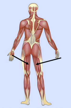<p>What major muscle is this?</p>