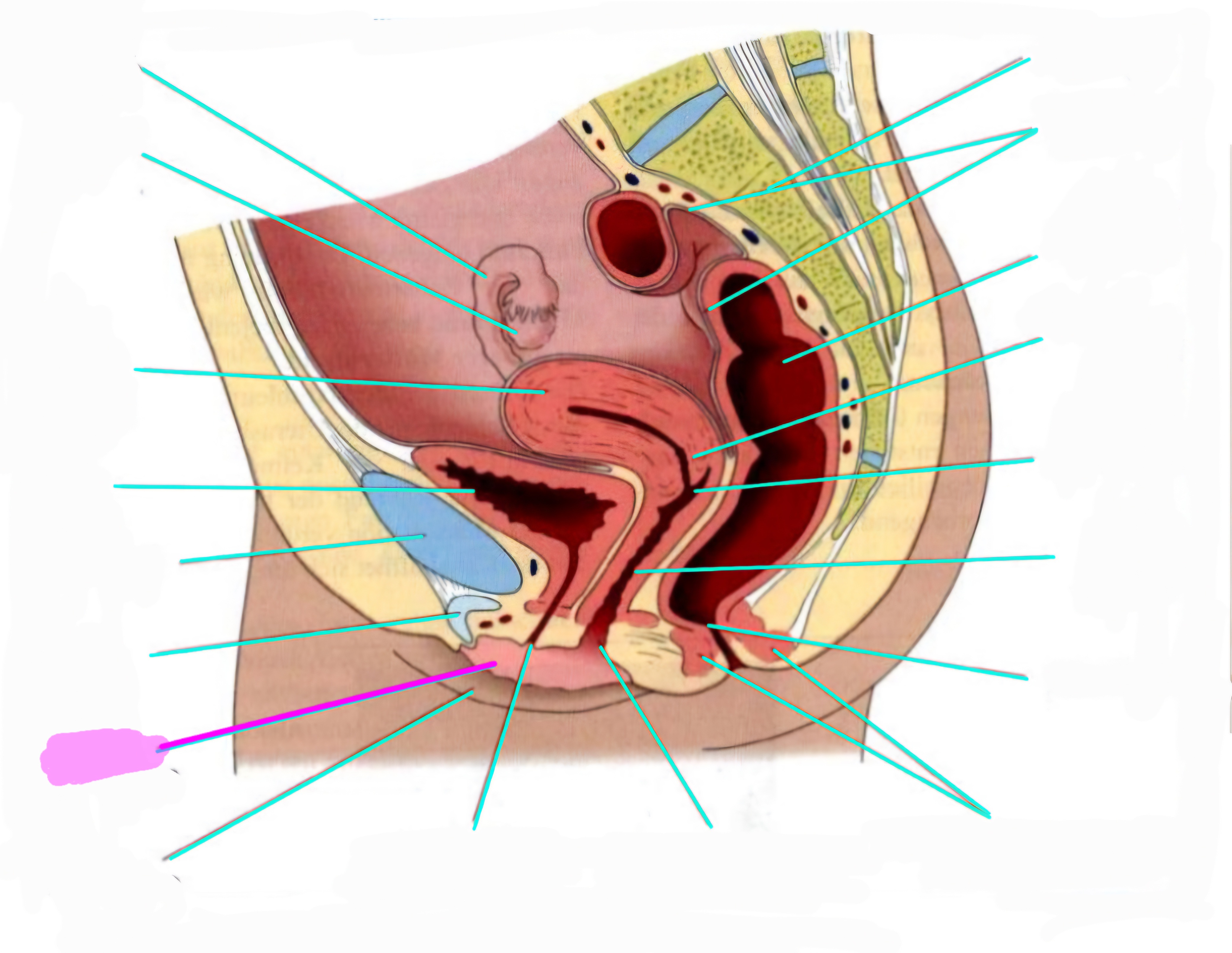 term image