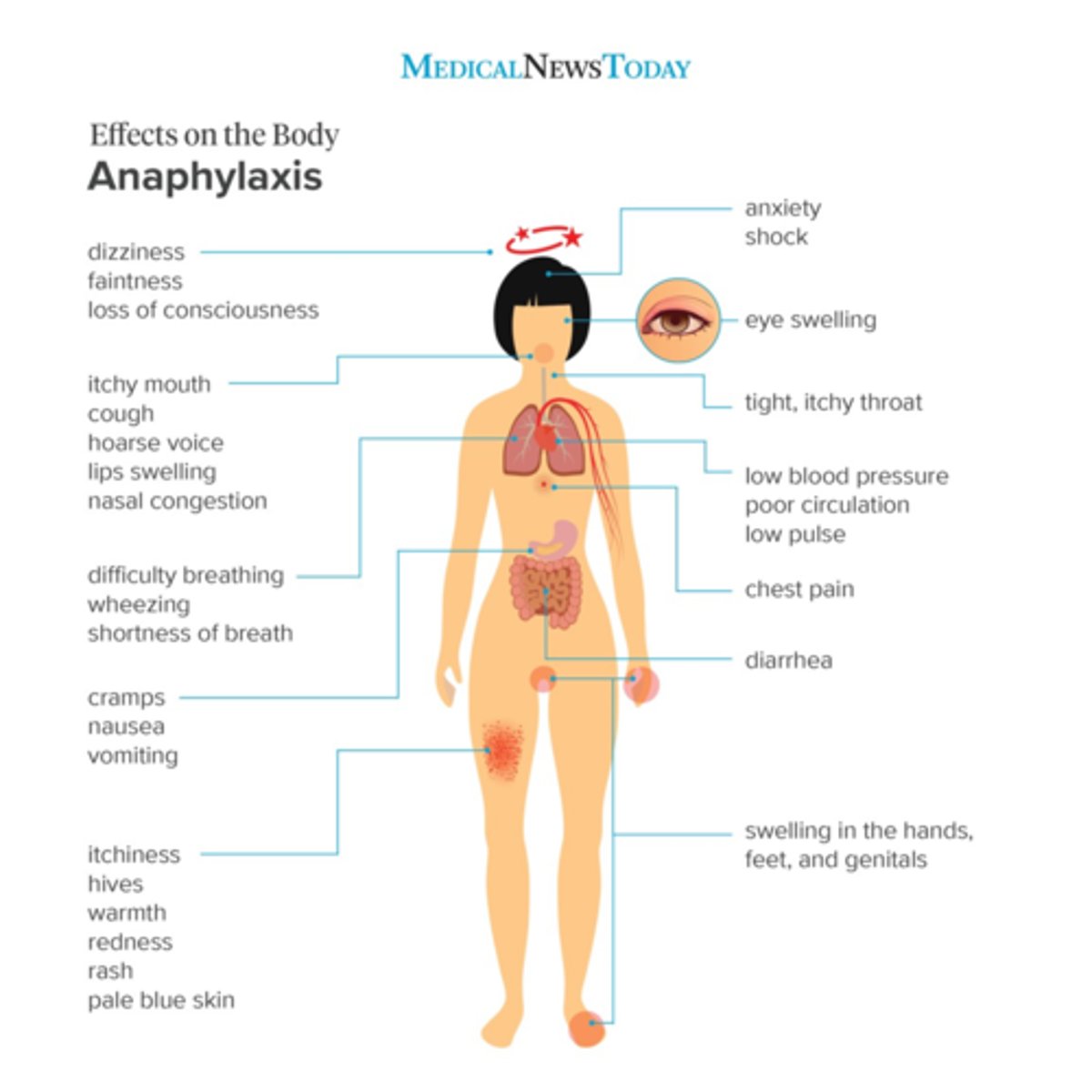 <p>1. lateral thigh (bunch skin if no fatty tissue; keep skin taut if fatty tissue present)</p><p>2. pierce quickly at 90 deg</p><p>3. inject 1mL per 1 sec</p><p>4. remove slowly</p>