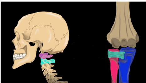 <p><strong>Vertebrae </strong>(between C1 and C2), and <strong>forearm</strong> (radius and ulna)</p>