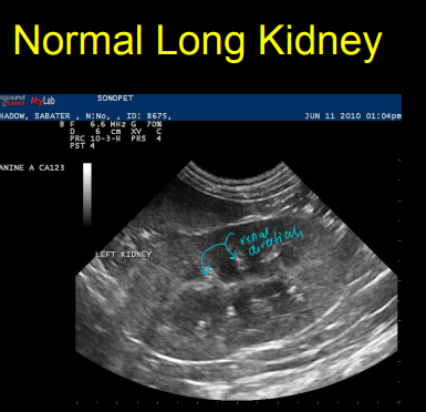 <p>Renal diseases on Ultrasound</p>