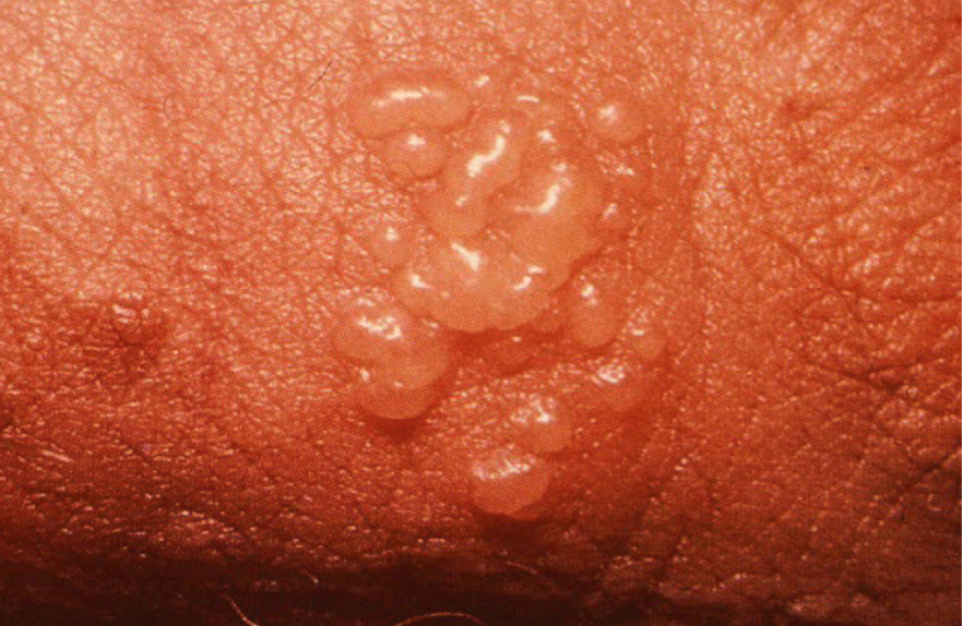 term image