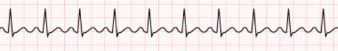 <p>Name the rhythm</p>