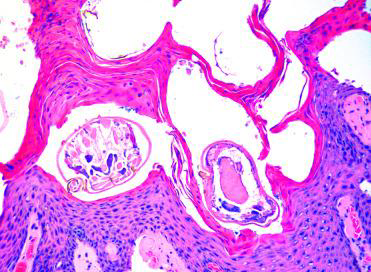 <p>Sarcoptic mange causes an ______ due to the itchiness</p>