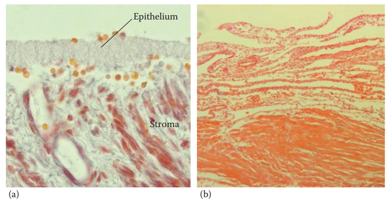 Uterus endometrium. (a) The proliferative phase and (b) the menstrual phase. (© Richard C. Li.)