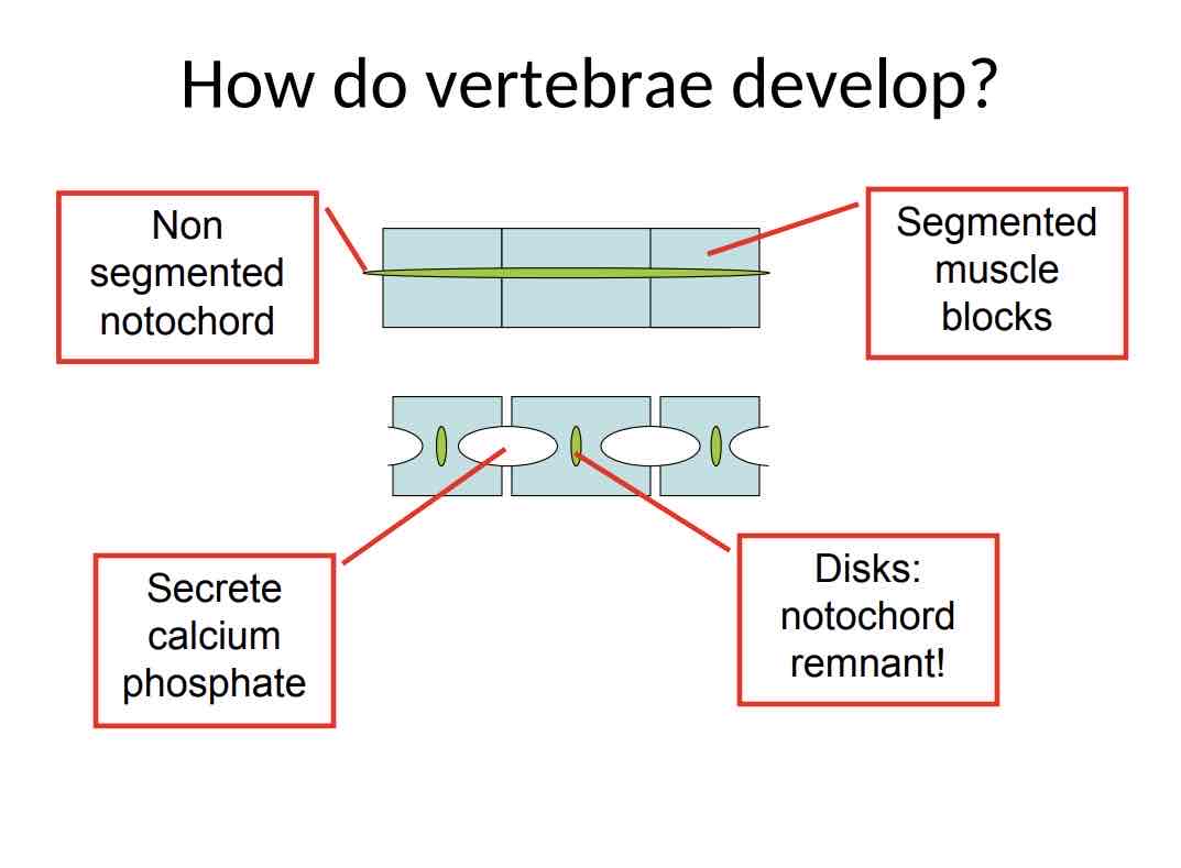 <p>Practice Question (Vertebrae) How do vertebrae develop ?</p>