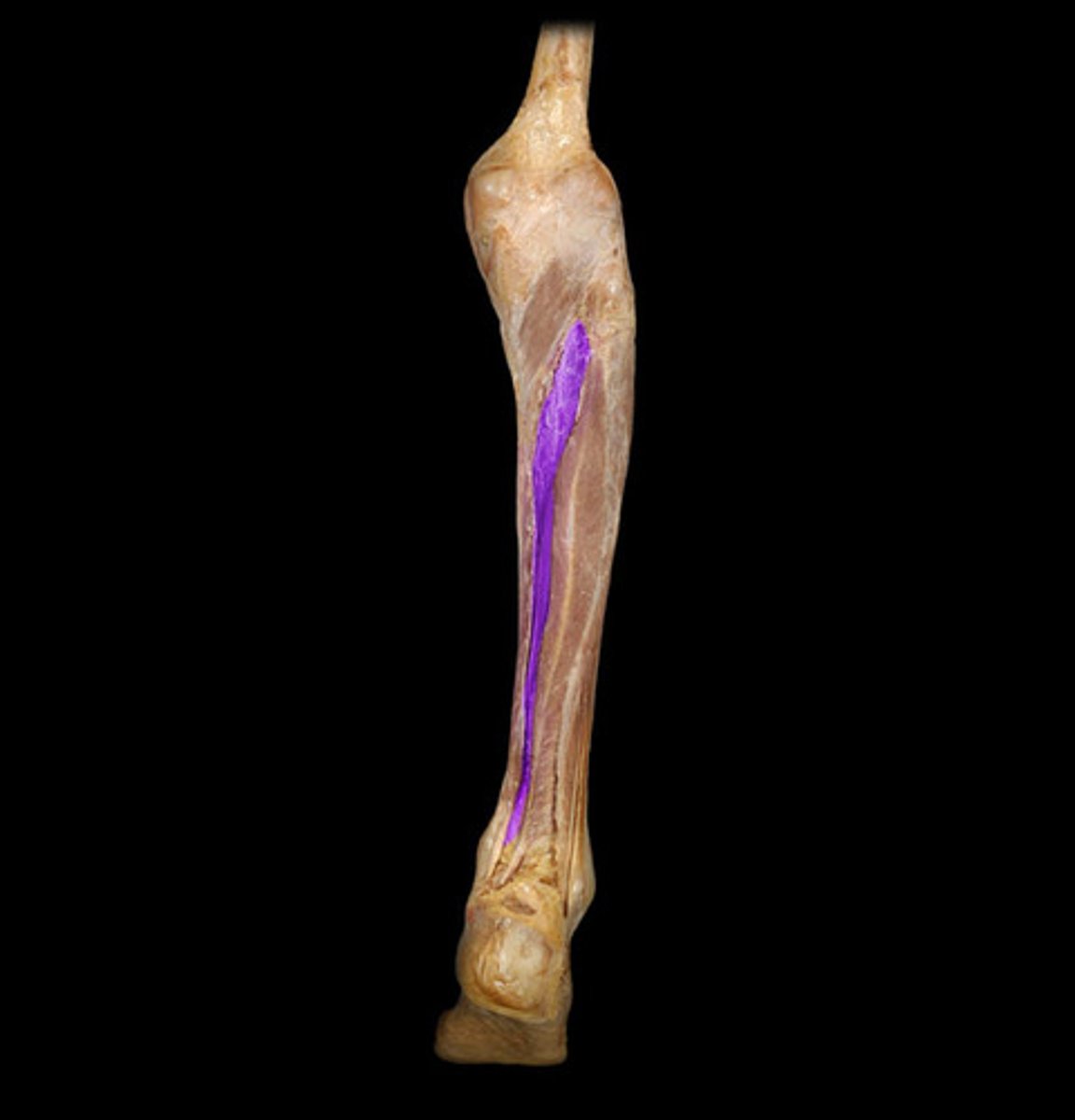 <p>Proximal attachment: Tibia and fibula</p><p>Distal attachment: Metatarsals 2-5, navicular, cuboid, and all cuneiforms</p><p>Comments, Applications and Relationships: Middle m. in the deep posterior compartment of the leg</p><p>Action: Plantar flexor of the foot at the ankle, inverts ankle.</p>