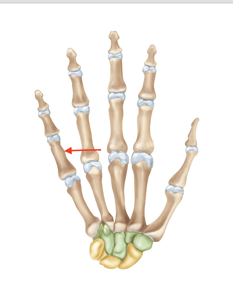 <p>Proximal Phalanx of Digit 5</p>