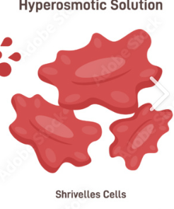 <p><span style="font-family: Calibri, sans-serif; line-height: 115%;"><strong><span>Hypertonic</span></strong></span></p>