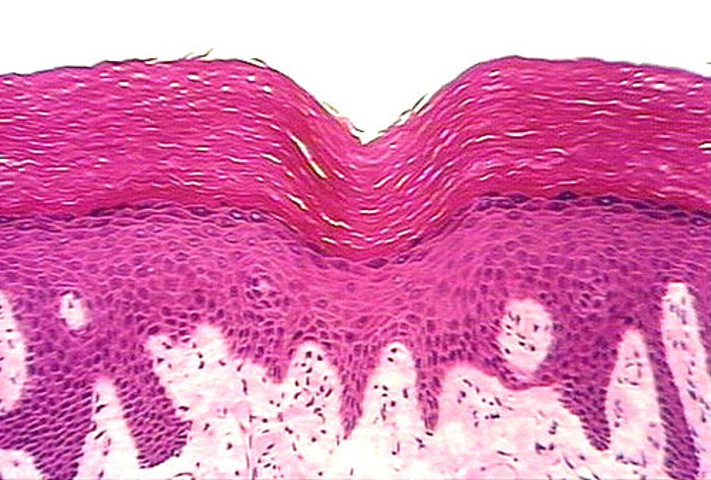<p>skin (epidermis)</p><p>top part is dead squamous cells, then the keratinized stratified epithelium on lop of connective tissue</p>