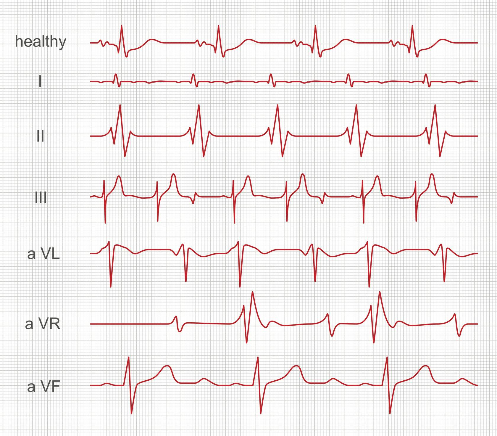 <p>What are <strong>electrocardiographs (ECG or EKG)? What do they do?</strong></p>