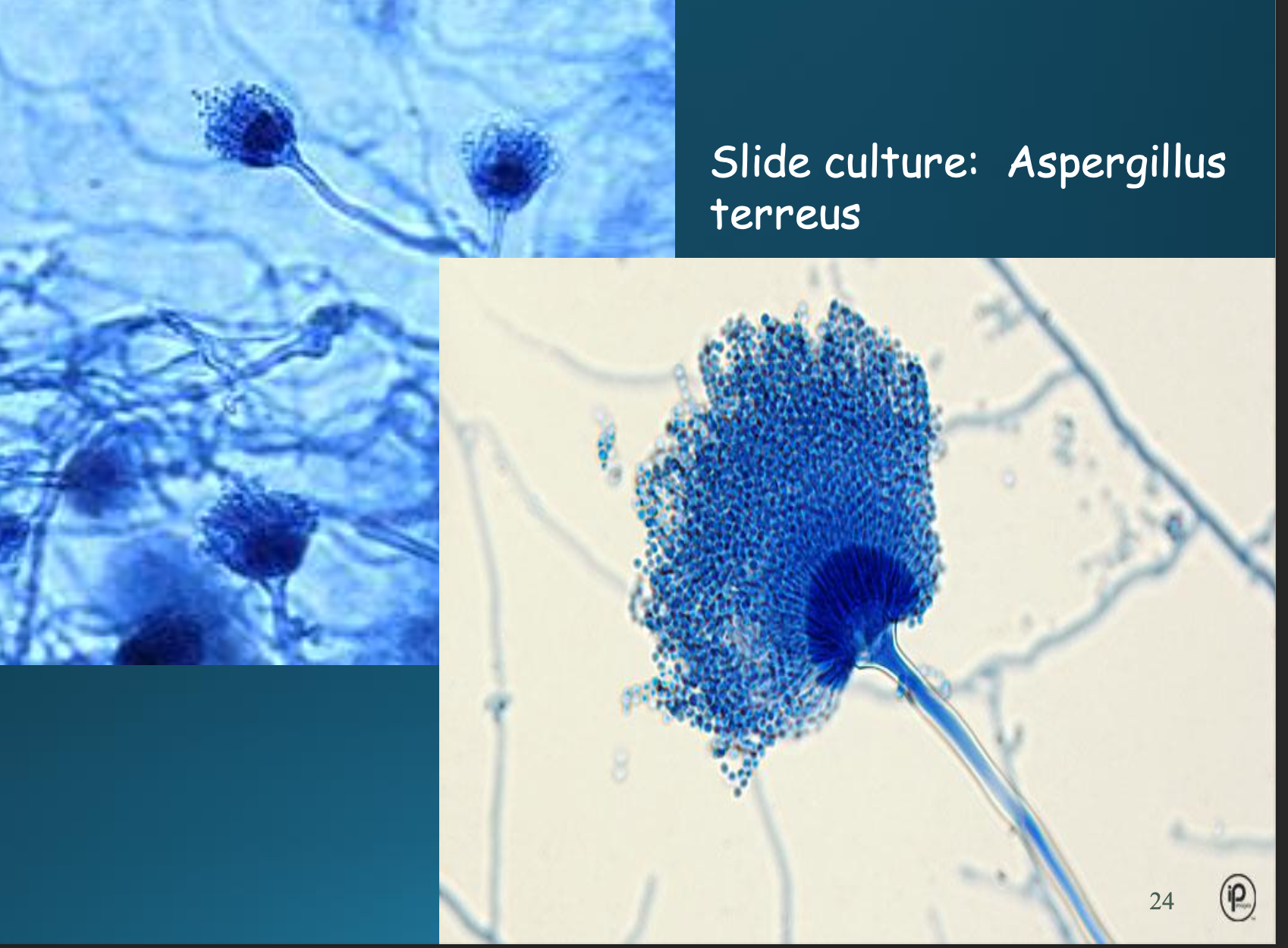 <p>How do Aspergillus terreus differ microscopically and macroscopically</p>