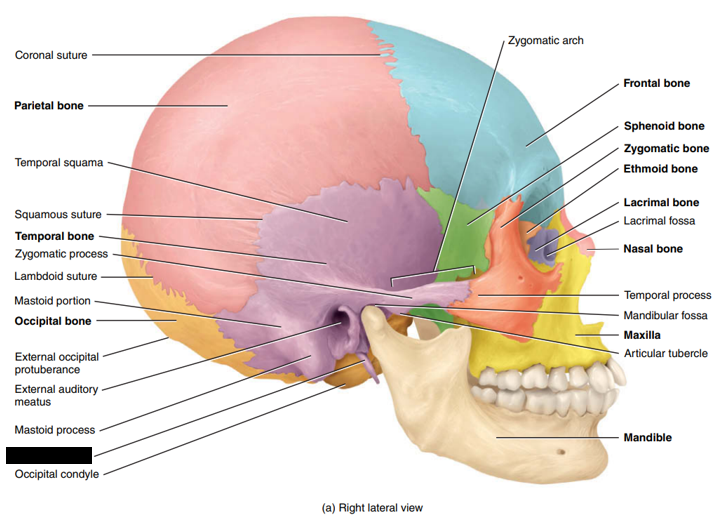 <p>State and identify what part of the cranial bone is being pointed out and censored. (hint: process)</p>