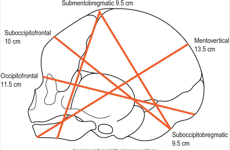 <ul><li><p>Suboccipitobregmatic - 9.5cm</p></li><li><p>Suboccipitofrontal - 10cm</p></li><li><p>Occipitofrontal - 11.5cm</p></li><li><p>Mentovertical - 13.5cm</p></li><li><p>Submentovertical - 11.5cm</p></li><li><p>Submentobregmatic - 9.5cm</p></li></ul><p></p>