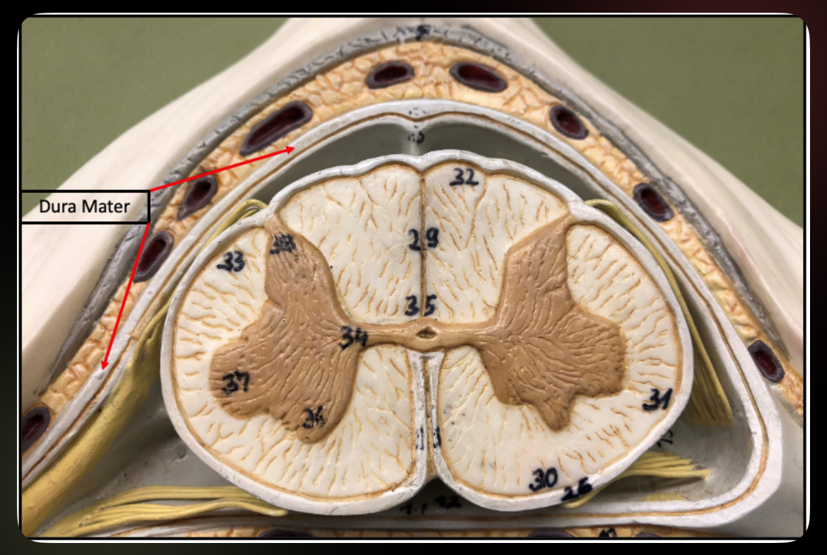 <p>Dura Mater (Spinal Cord)</p>