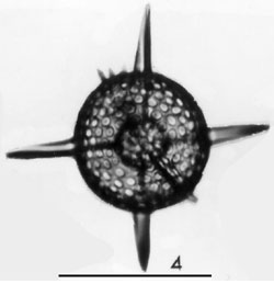 <p>Which protist is this?</p>