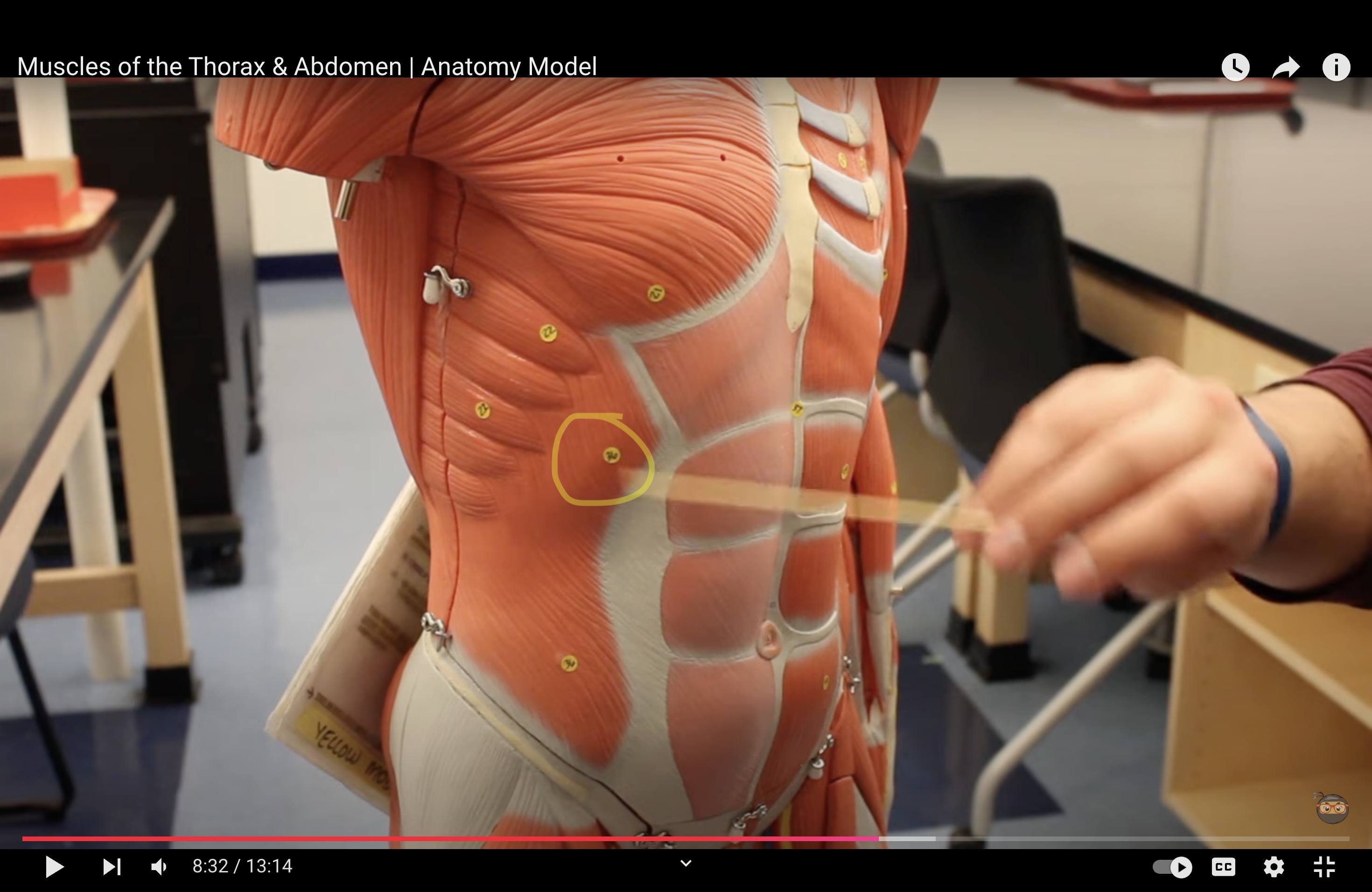 <p>What muscle is this?*****</p>