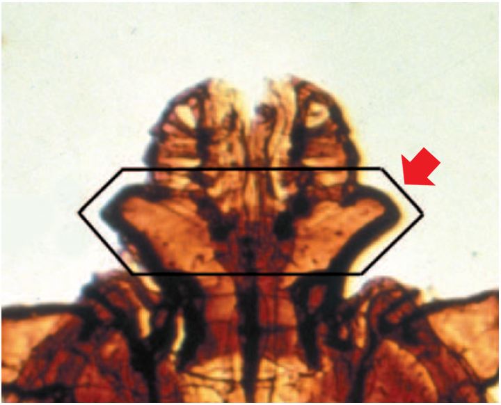identify the pointed structure