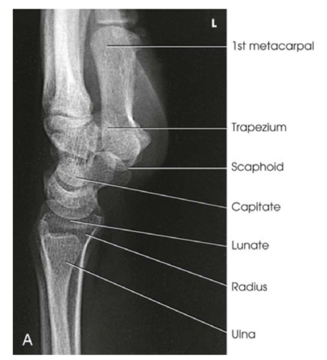 <p>- distal radius and ulna, carpals, and proximal half of metacarpals</p><p>- superimposed distal radius and ulna</p><p>- superimposed metacarpals</p>