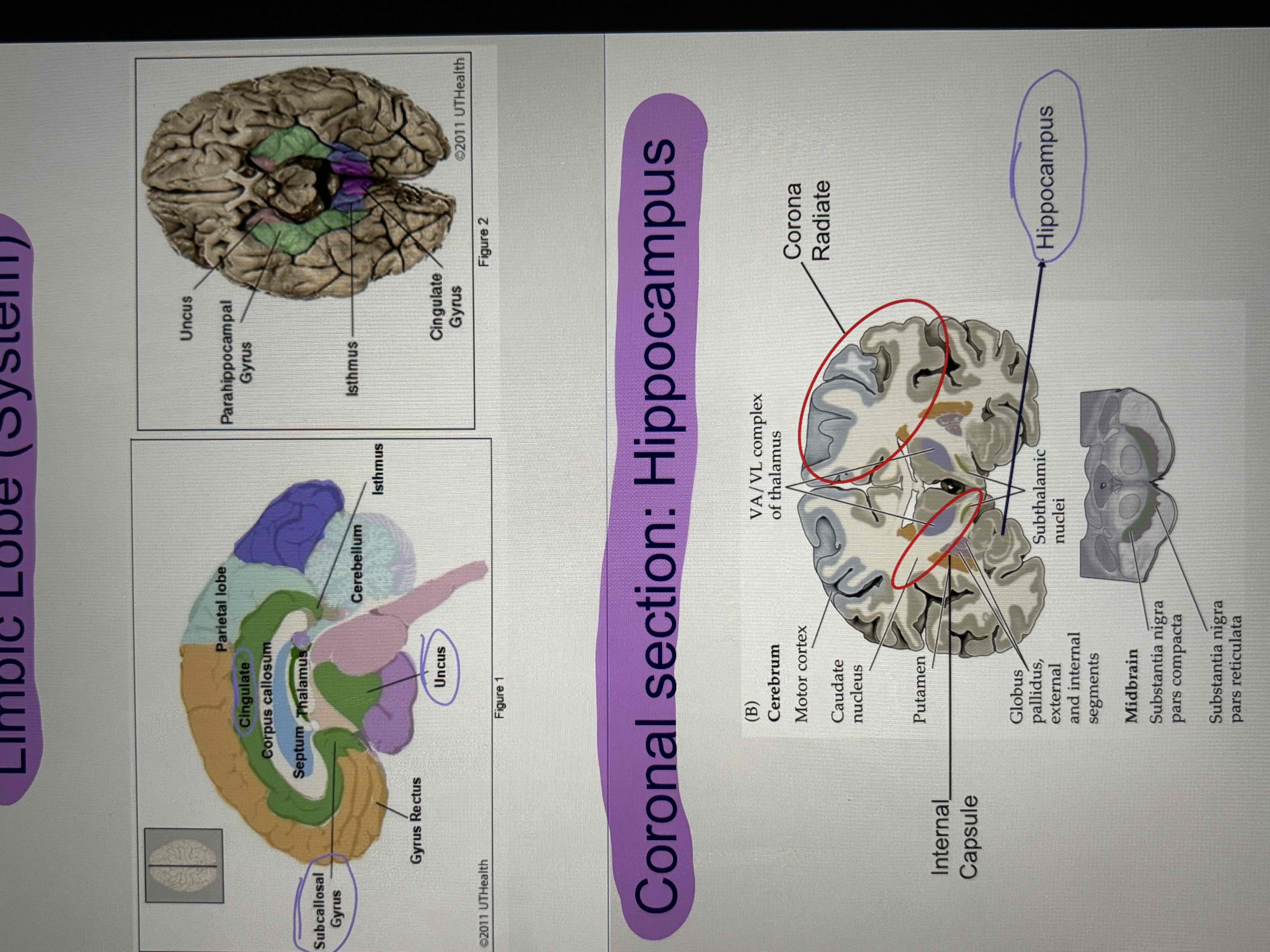 <ul><li><p>functional grouping of structures along the medial and inferior aspects of the cortex </p></li><li><p>Involved in long term memory and learning, drive related behavior, olfaction, and emotional function</p></li><li><p>Contains: cingulate gyrus, parahippocampal gyrus (uncus), subcallosal gyrus, hippocampus </p></li></ul>