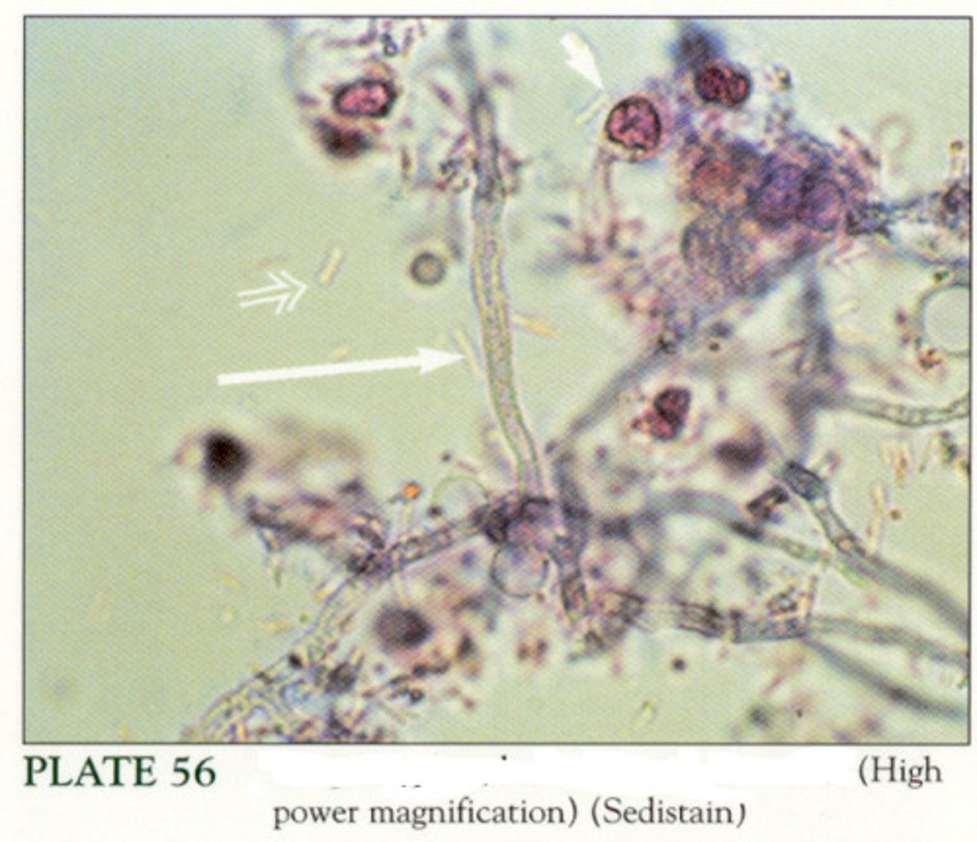 <p>A kingdom of eukaryotic organisms that grow in irregular masses, without roots, stems, or leaves, and are devoid of chlorophyll or other pigments capable of photosynthesis. Each organism (thallus) is unicellular to filamentous, and possesses branched somatic structures (hyphae) surrounded by cell walls containing glucan or chitin or both, and containing true nuclei. They reproduce sexually or asexually (spore formation), and may obtain nutrition from other living organisms as parasites or from dead organic matter as saprobes (saprophytes).</p>