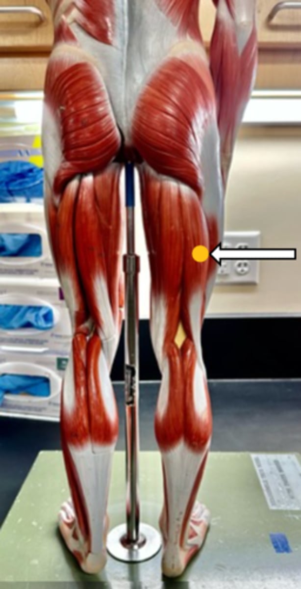 <p>biceps femoris (function)</p>