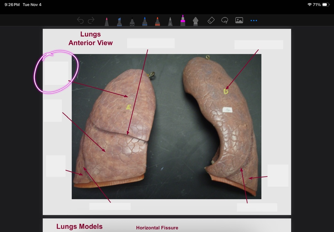 <p>What is this?</p>